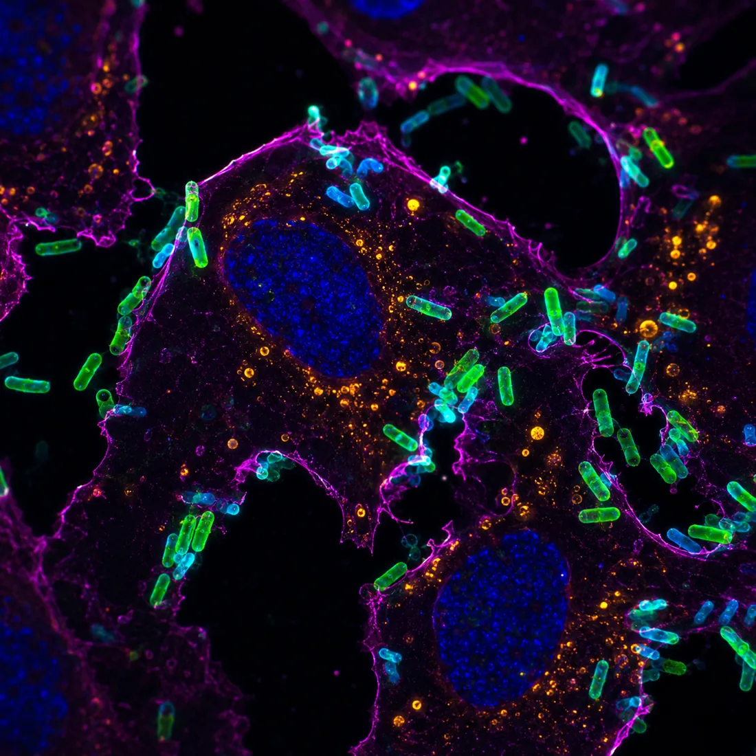 Uropathogenic E. coli adhering to bladder epithelium — fluorescence rendering