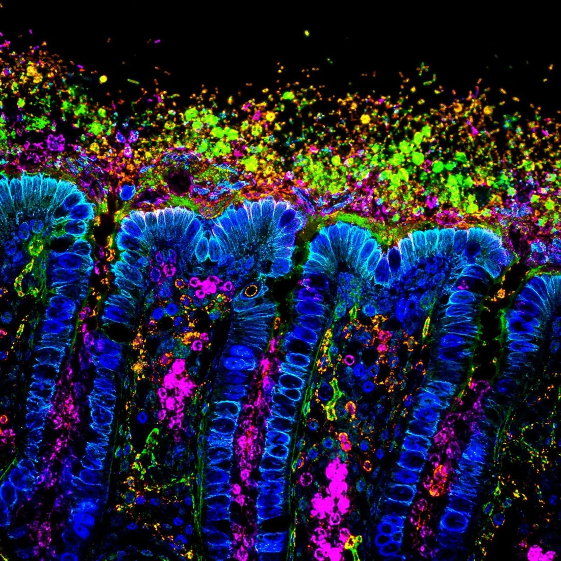 结肠菌群、生物膜与黏膜生态示意荧光图