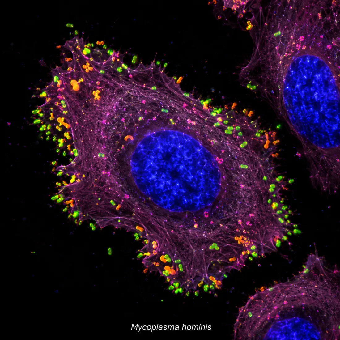 Mycoplasma hominis 分子检测示意荧光图：无细胞壁支原体在黏膜表面定植